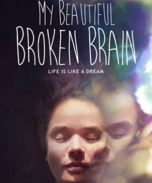 Khối óc xinh đẹp tội nghiệp của tôi - My Beautiful Broken Brain